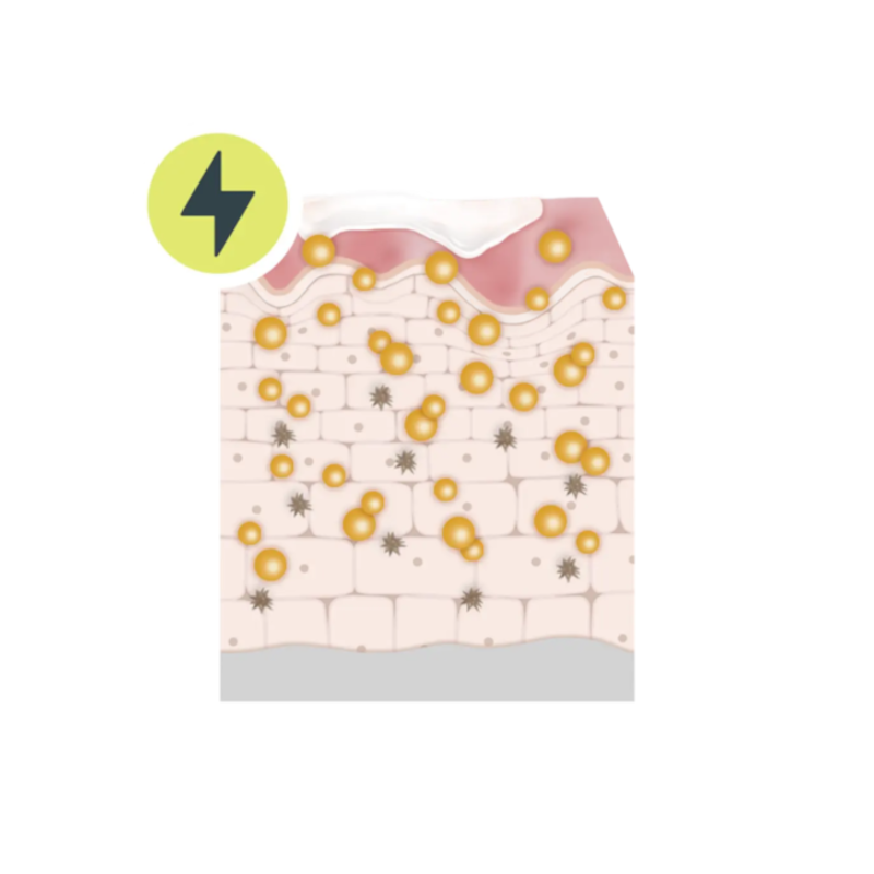 Boosting of anti-oxidant levels
